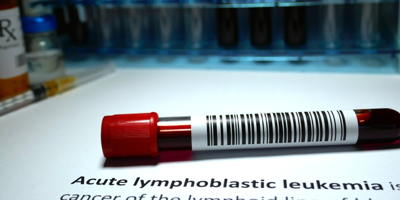 Bệnh bạch cầu lymphoblastic cấp tính là một loại ung thư máu đặc trưng bởi sự tăng sinh không kiểm soát của các tế bào lymphoblast