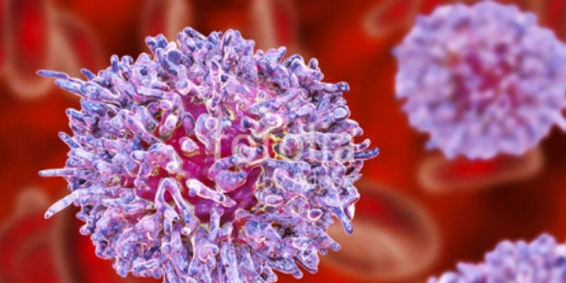 Có nhiều nguyên nhân khác nhau gây ra bệnh Leukemia