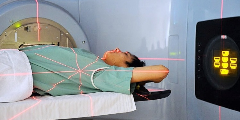 Xạ trị trong điều trị ung thư vú