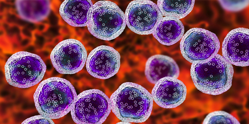 Paget vú là một dạng ung thư hiếm gặp do sự phát triển tế bào ác tính ở vùng núm vú