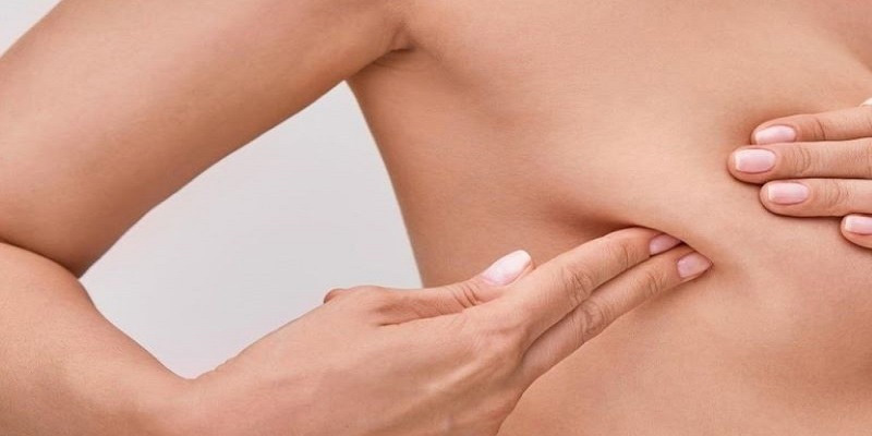 U xơ tuyến vú có cần mổ không