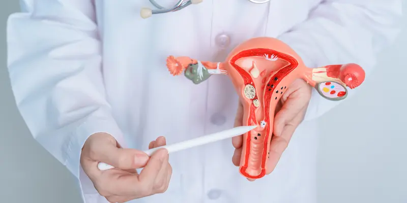 Tìm hiểu về ung thư cổ tử cung