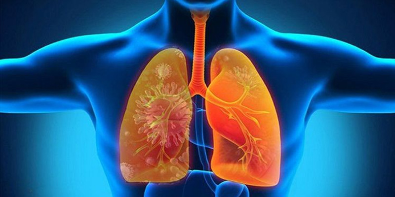 Ngoài ung thư phổi có lây không nhiều người còn quan tâm đến ung thư phổi có di truyền không