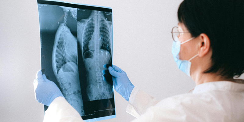 Mục tiêu chính trong điều trị ung thư phổi giai đoạn cuối là giảm nhẹ triệu chứng