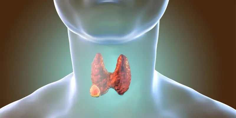 Liệu ung thư tuyến giáp có chữa khỏi không