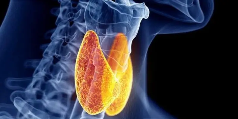 Ung thư tuyến giáp giai đoạn 3 sống được bao lâu là câu hỏi được nhiều người quan tâm