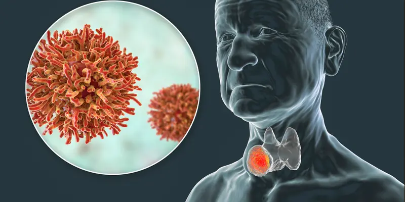 Khả năng bệnh ung thư tuyến giáp thể nhú sống được bao lâu?