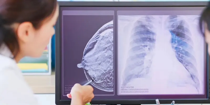 Rất nhiều người muốn biết ung thư vú di căn có chữa được không​