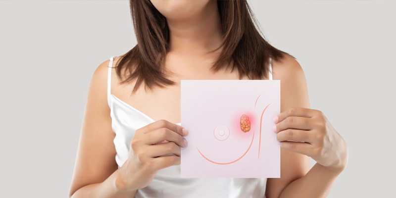 Tam thất có tiềm năng đáng kể trong việc hạn chế và ngăn ngừa ung thư vú