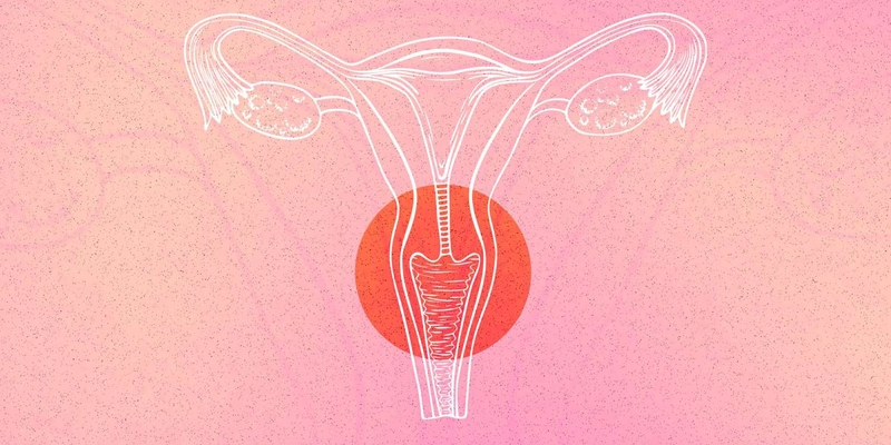 Ung thư cổ tử cung là tình trạng bệnh ác tính với tác nhân hàng đầu là HPV