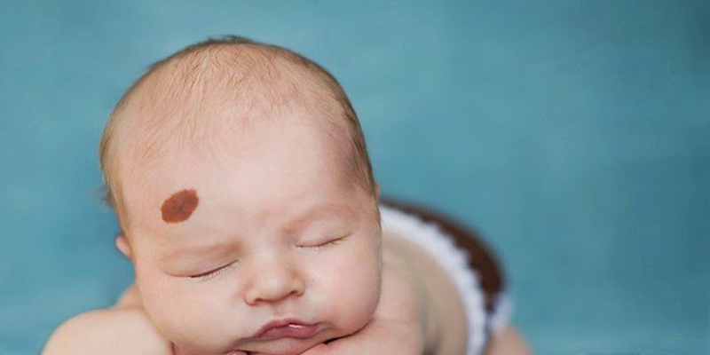 Xác định giai đoạn ung thư giúp các bác sĩ quyết định phương thức điều trị tốt nhất