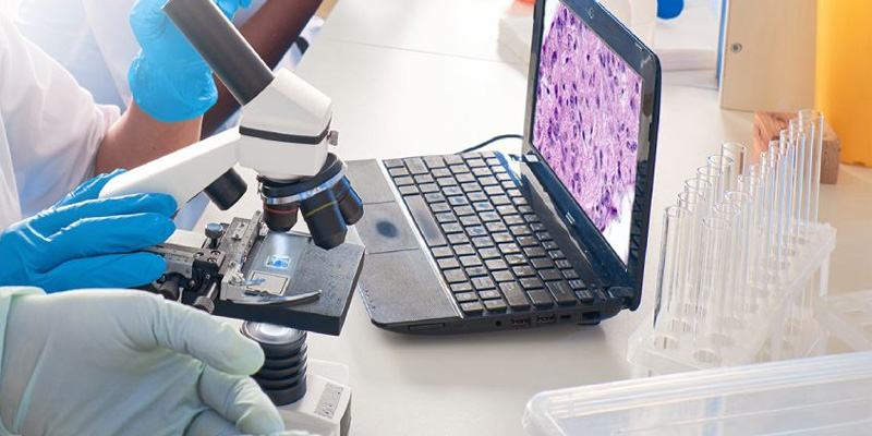 Có thể sinh thiết phổi theo những kỹ thuật khác nhau