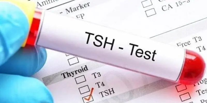TSH là xét nghiệm cần thực hiện đầu tiên khi xét nghiệm ung thư tuyến giáp