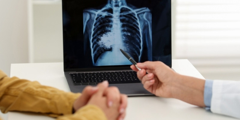 Chẩn đoán các giai đoạn ung thư phổi bằng nhiều cách khác nhau