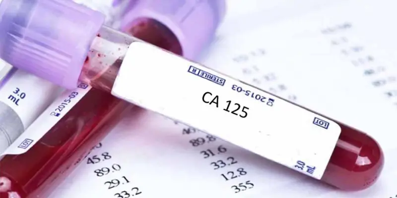 Xét nghiệm CA 125 trong máu