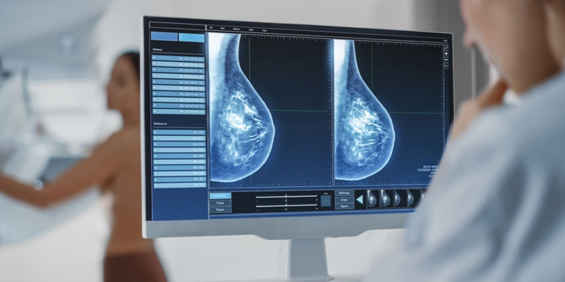 Chụp X-quang vú giúp bác sĩ dễ dàng xác định tình trạng bệnh