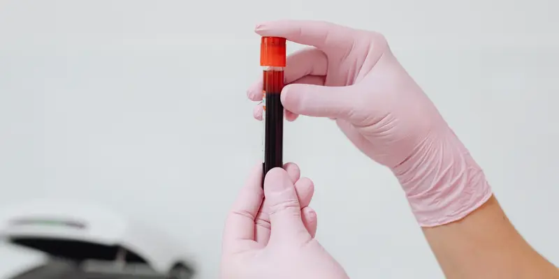 Chẩn đoán các khối u tủy sống bằng cách xét nghiệm máu