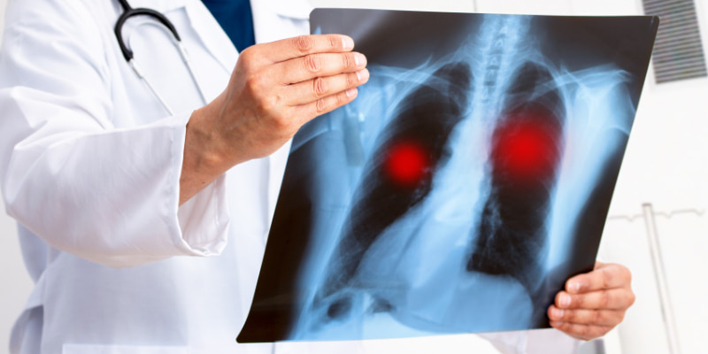 Chẩn đoán nhằm mục đích xác định giai đoạn bệnh, chỉ định cách điều trị phù hợp