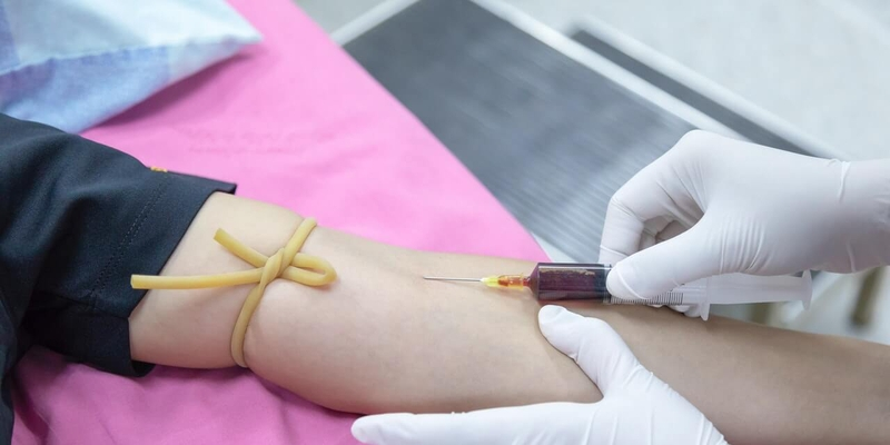 Xét nghiệm máu giúp chẩn đoán và theo dõi ung thư máu cấp tính