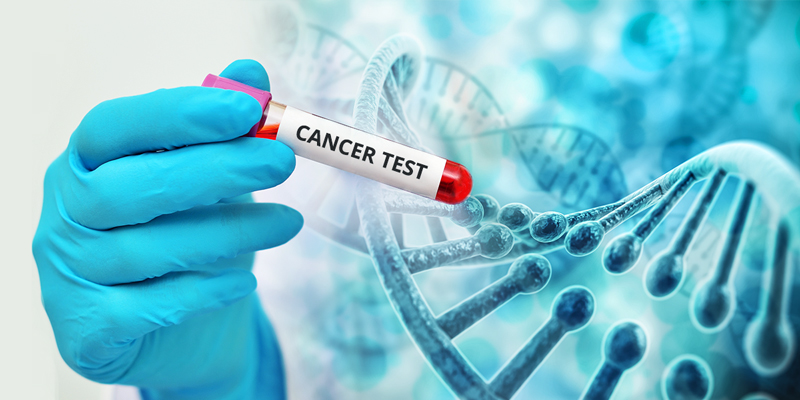 Xét nghiệm gen có thể phát hiện các đột biến liên quan giúp phát hiện ung thư