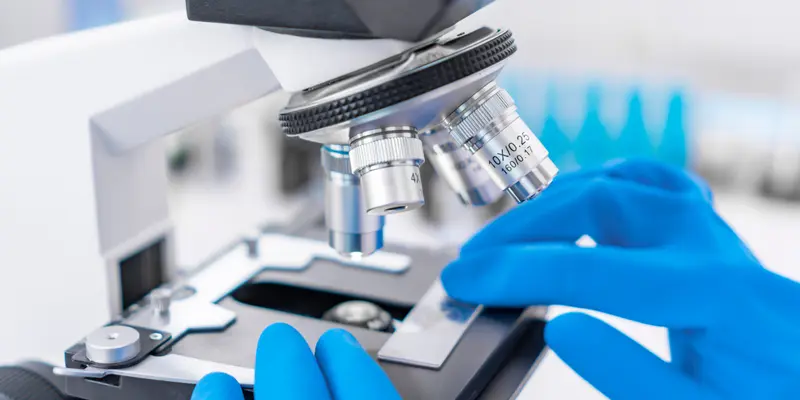 Xét nghiệm sinh thiết hỗ trợ chuẩn đoán ung thư