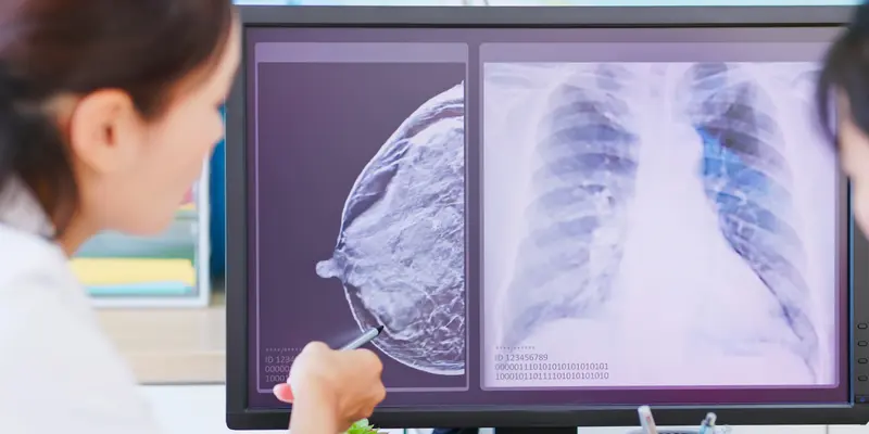 Chụp nhũ ảnh để chụp hình ảnh chi tiết bên trong mô vú, phục vụ cả mục đích sàng lọc và chẩn đoán