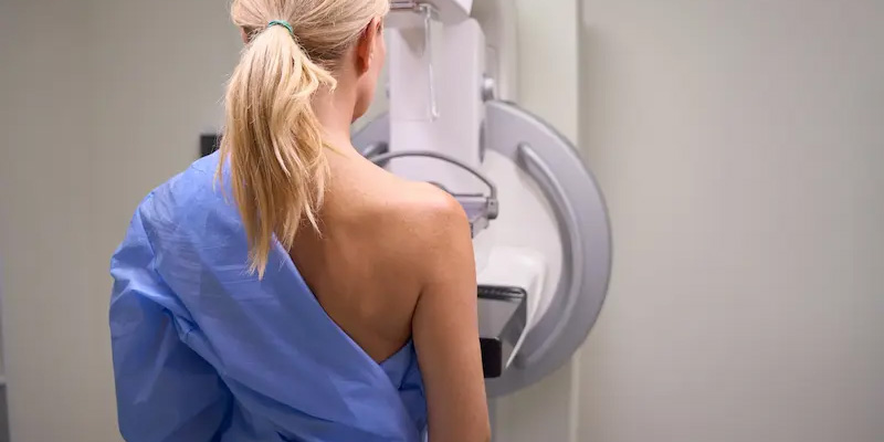 Hệ thống chụp nhũ ảnh kỹ thuật số (DBT) sẽ giúp phát hiện ung thư vú giai đoạn 0 để điều trị kịp thời.