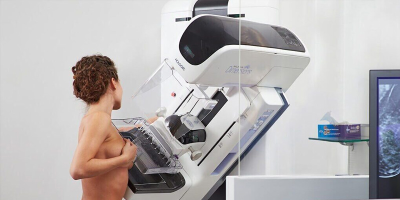 Phương pháp chụp nhũ ảnh giúp chẩn đoán căn bệnh ung thư vú ống dạng nhỏ