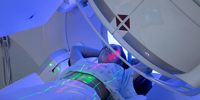 Chi phí điều trị ung thư hạch với phương pháp xạ trị