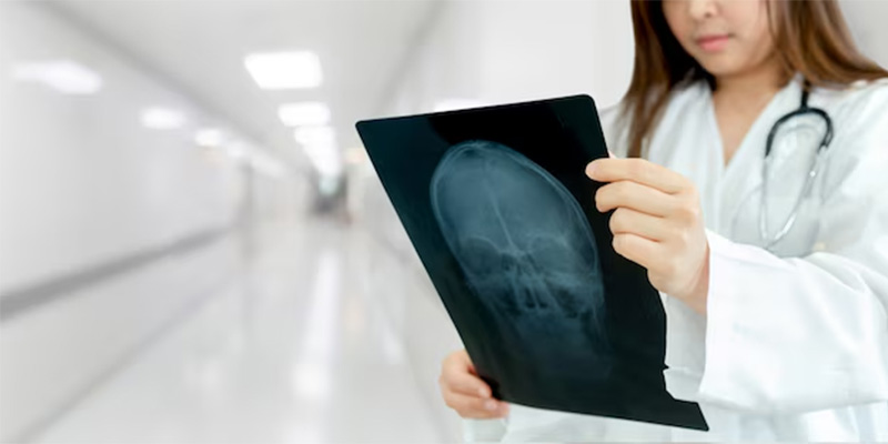 Có nhiều phương pháp điều trị ung thư não di căn