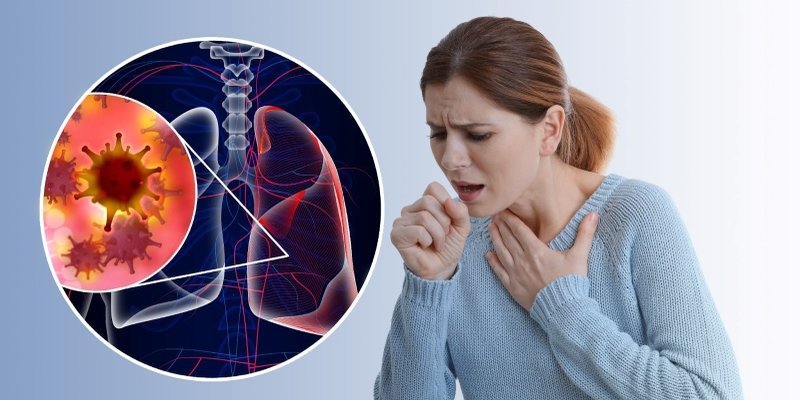 Lao phổi là bệnh lý truyền nhiễm do trực khuẩn lao gây ra