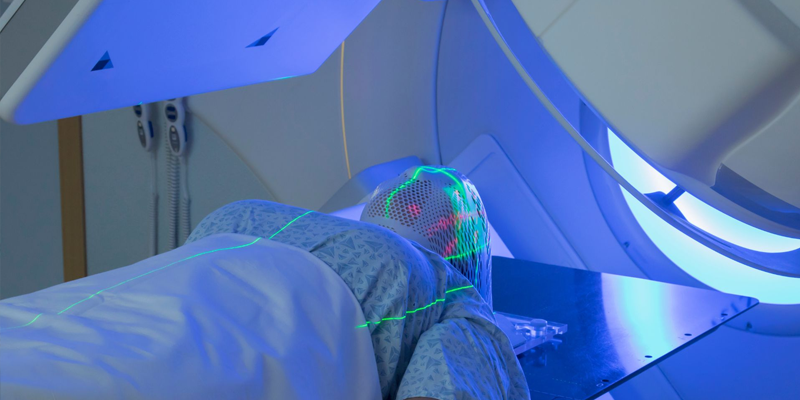 Xạ trị là một phương pháp được áp dụng trong điều trị ung thư phổi đã di căn xương