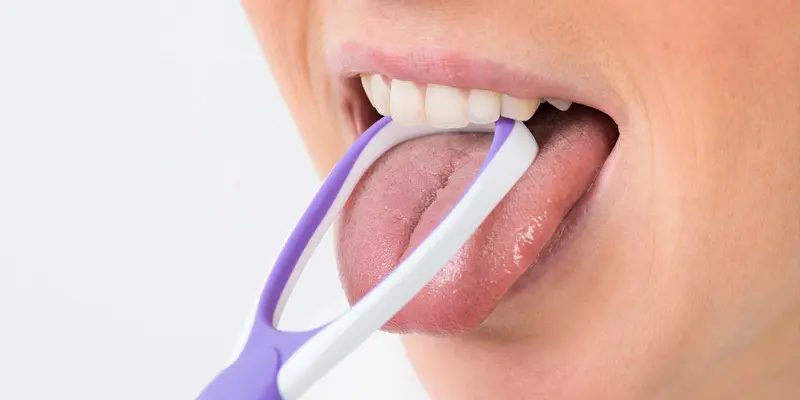 Điều trị ung thư lưỡi ở mặt trước