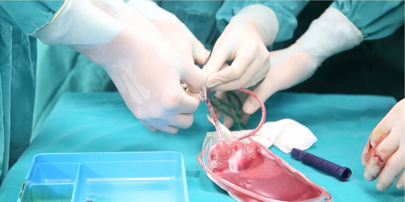 Tế bào gốc giúp tăng tỉ lệ thành công khi điều trị các bệnh lý trong tương lai