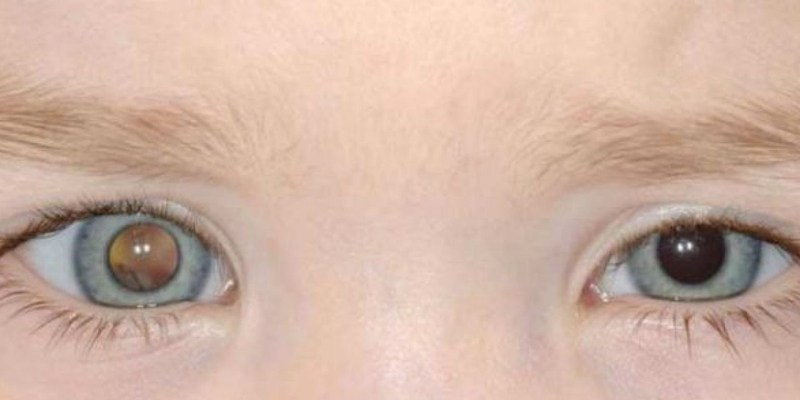 Việc điều trị phụ thuộc vào tình trạng khối u và đã xấm lấn các cơ quan khác hay chưa