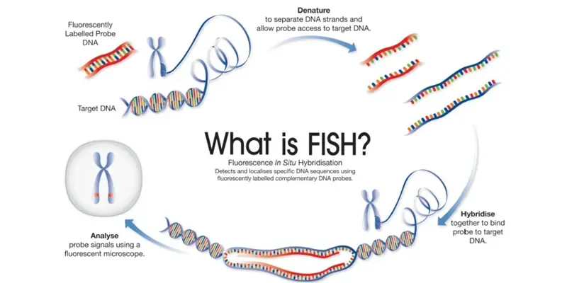 Kỹ thuật FISH đã đánh dấu một bước tiến quan trọng trong việc điều trị ung thư vú