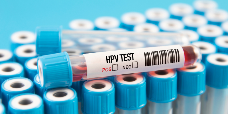 Kết quả xét nghiệm HPV cho biết sự hiện diện của virus HPV