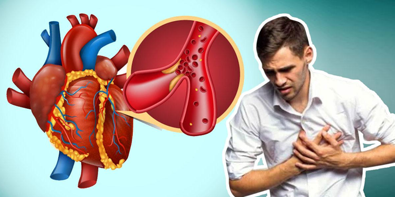 Người có bệnh tim mạch