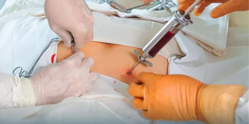 Việc lựa chọn phương pháp ghép tủy phụ thuộc vào thể bệnh và thể trạng của bạn