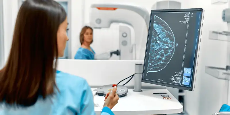 Liệu pháp xạ trị điều trị ung thư vú