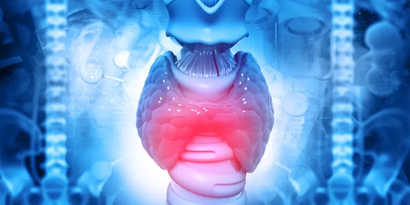 Ung thư tuyến giáp thể nhú là dạng phổ biến nhất