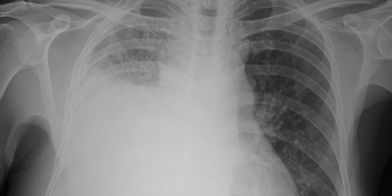 Điều kiện sức khỏe ảnh hưởng đến quá trình thực hiện
