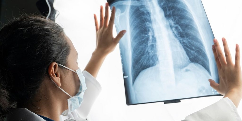 Kiểm tra và thăm khám giúp xác định khối u trong phổi