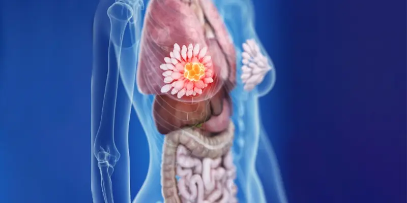 Phương pháp điều trị ung thư vú phụ thuộc vào nhiều yếu tố như: loại ung thư vú, các phương pháp điều trị trước đó và sức khỏe tổng thể của người bệnh