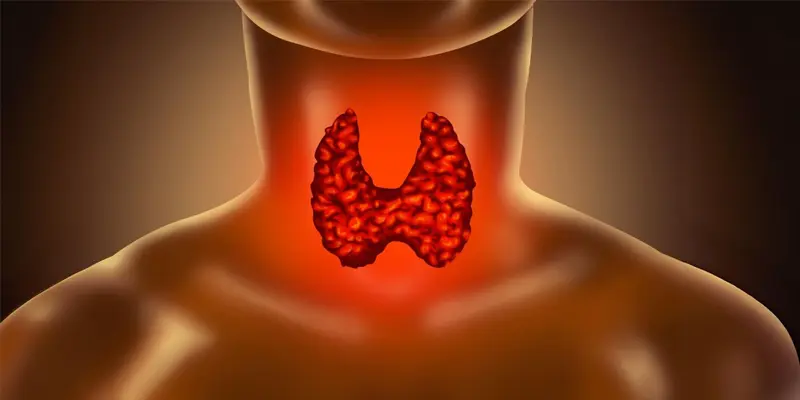 U tuyến giáp có uống được tảo biển không là câu hỏi thường được đặt ra