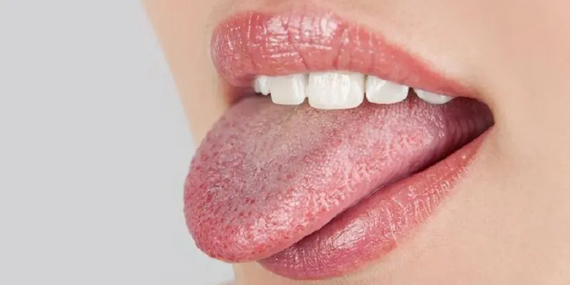 Lưỡi có đốm đỏ có thể xuất hiện do nhiều nguyên nhân khác nhau