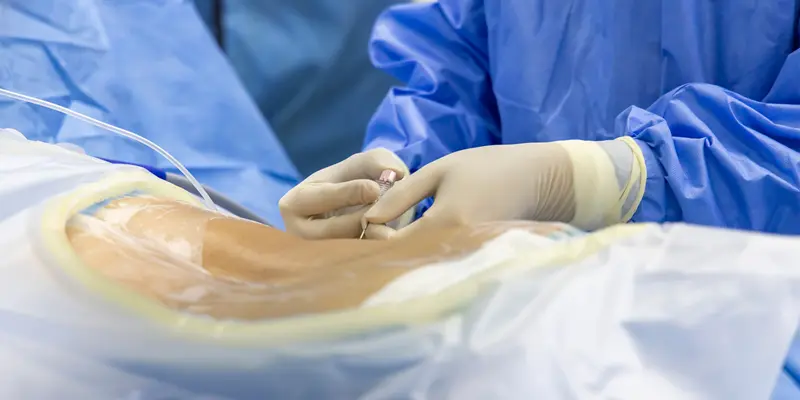 Mỗ hay phẫu thuật ung thư tủy sống điều có thể gây rủi ro