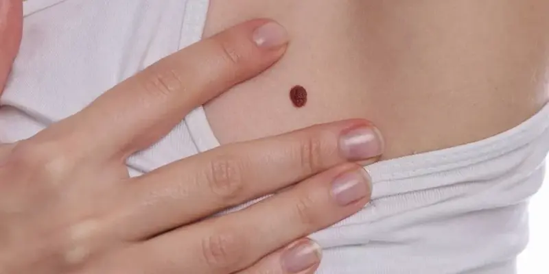 Mức độ nguy hiểm của ung thư vú phụ thuộc vào giai đoạn phát hiện bệnh