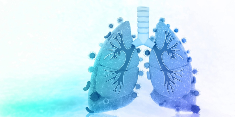 Những người có tiền sử viêm phổi hoặc các bệnh hô hấp mãn tính có nguy cơ mắc ung thư phổi cao hơn