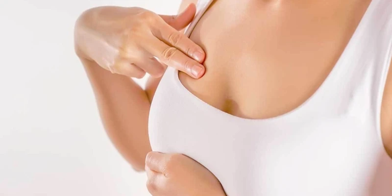 Nhiễm trùng vú kéo dài có thể dẫn đến hình thành khối u tuyến vú